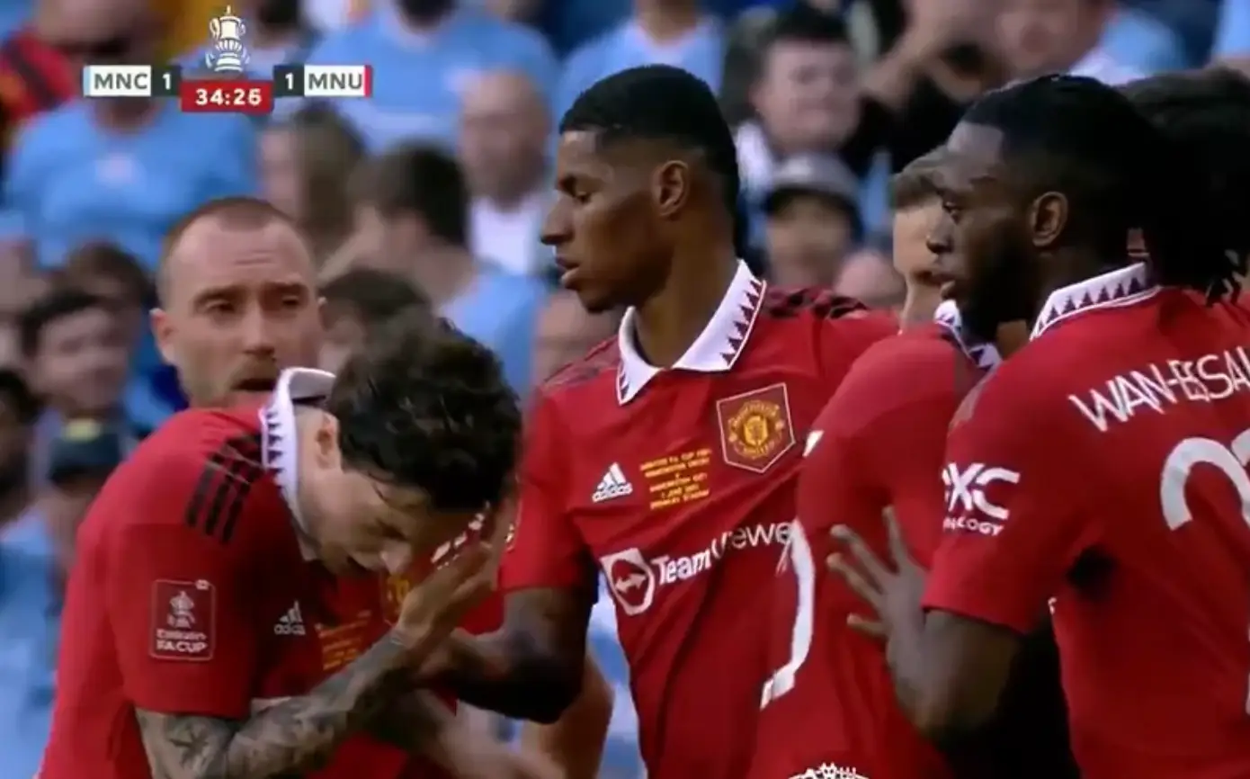 The Man Utd player was stuck in eye.