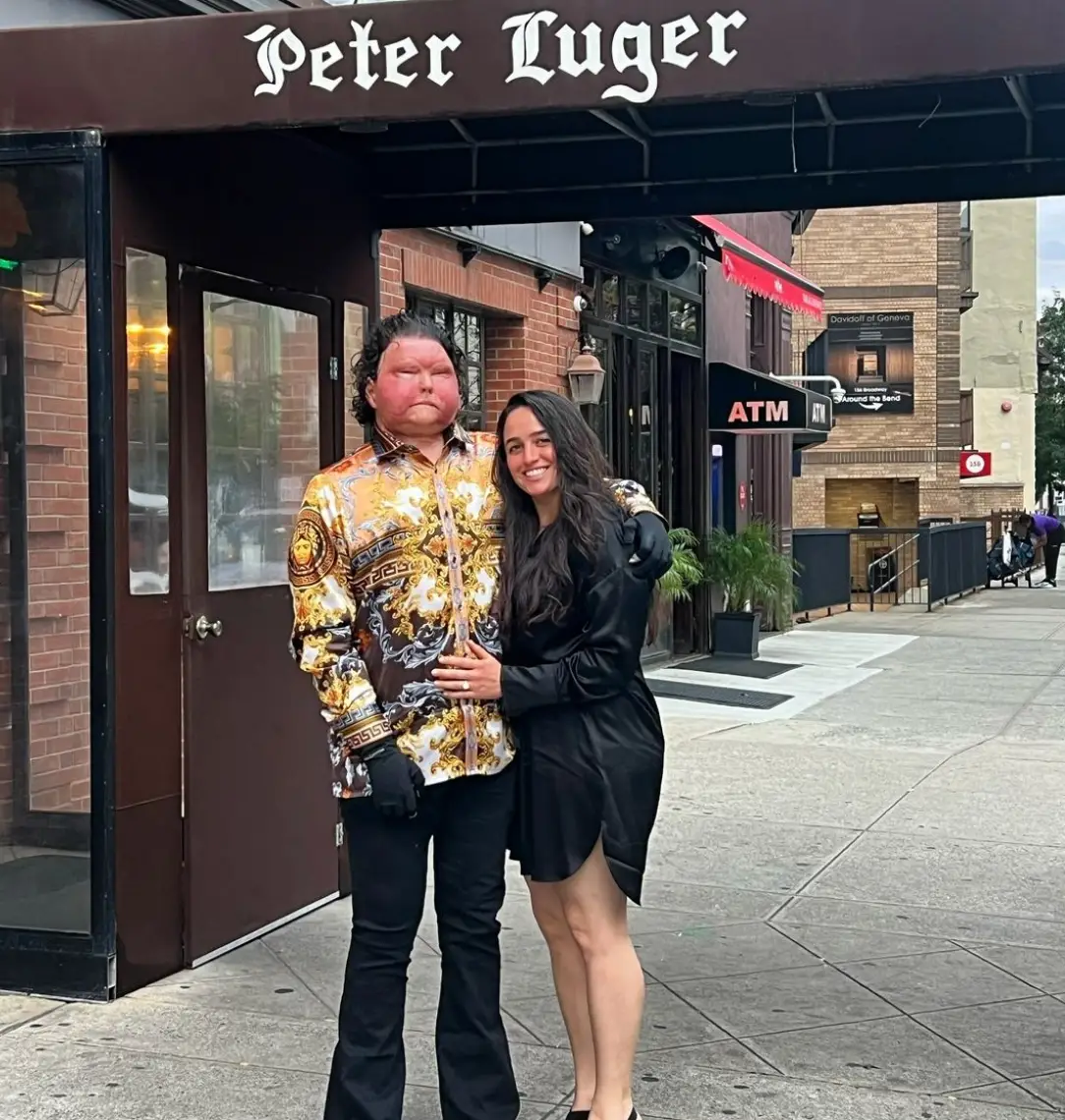 Joe DiMeo, the world's first successful face transplant recipient, is now engaged to partner Jessica Koby (Instagram/joeroydimeo/Jam Press)