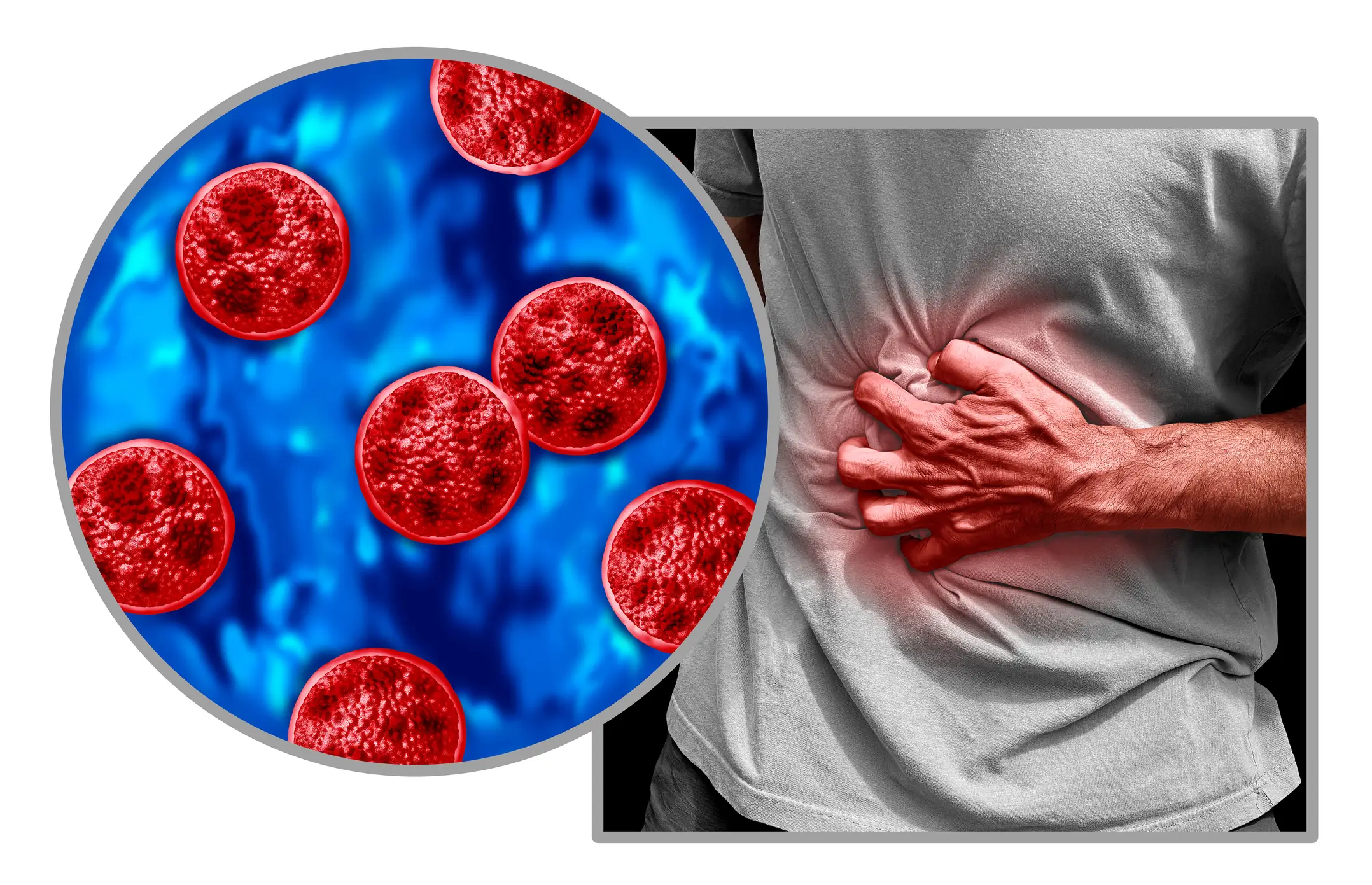 There's been 1,600 cases of cyclosporiasis since May in the US, with an additional 5,100 cases currently under investigation (Getty Stock Images)