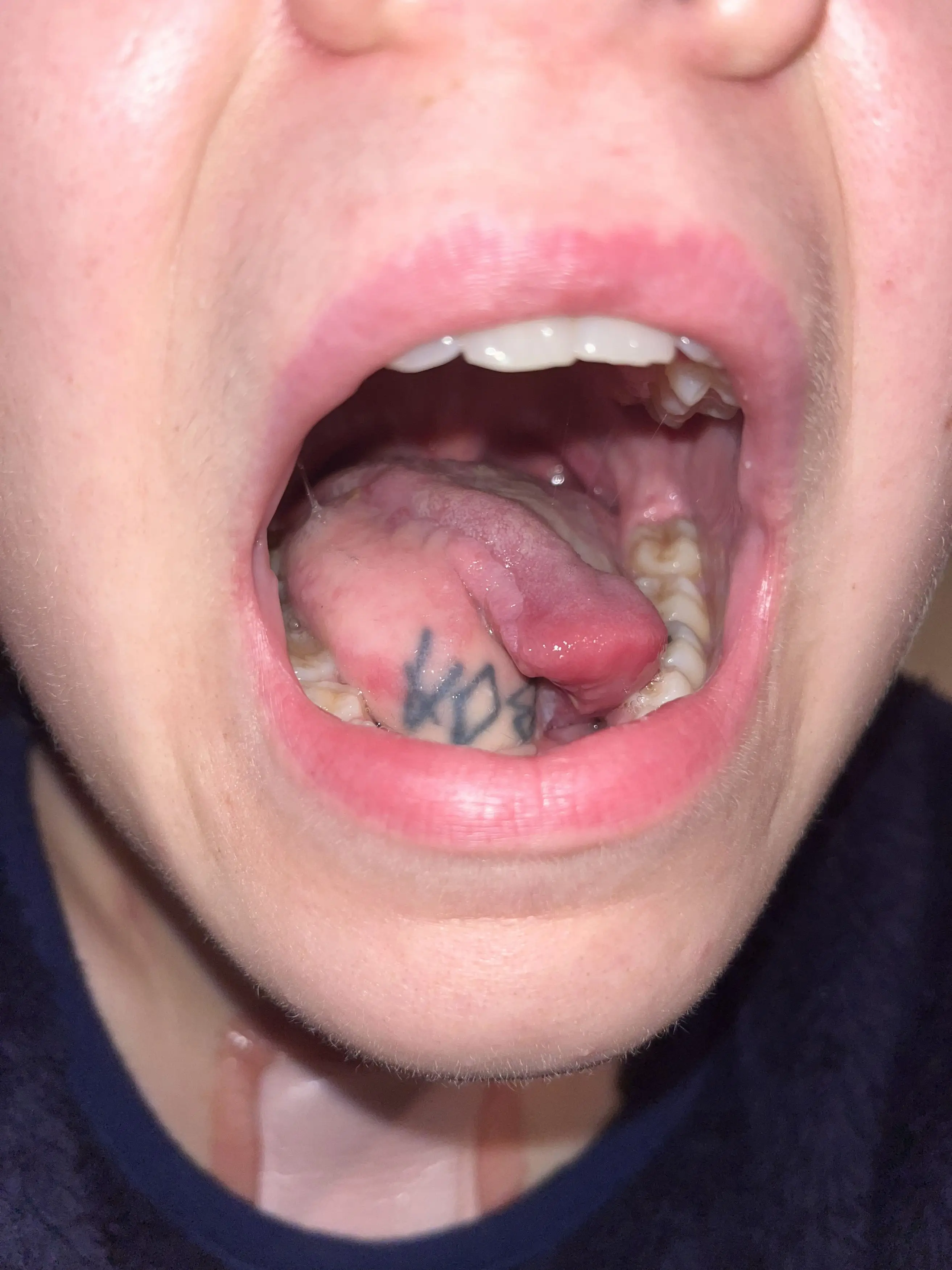 The tattoo can still be seen under her tongue (Kennedy News and Media)