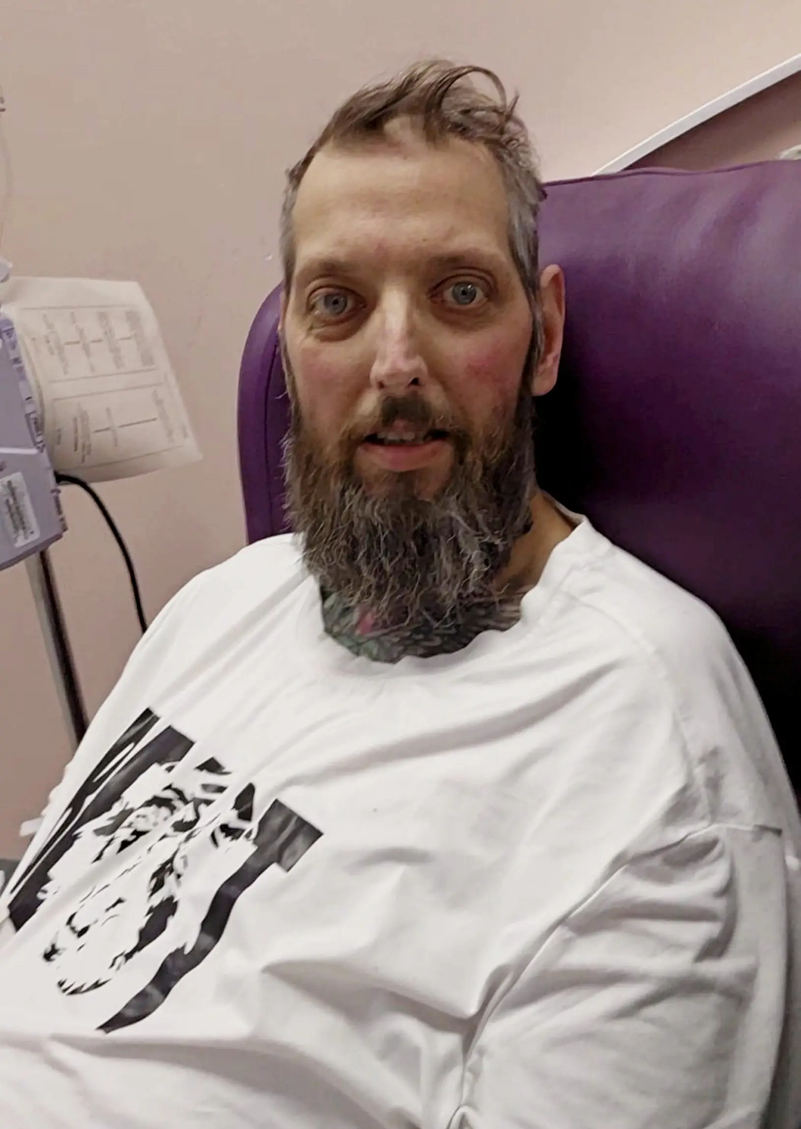 The dad has lost 35kg since his diagnosis (SWNS)