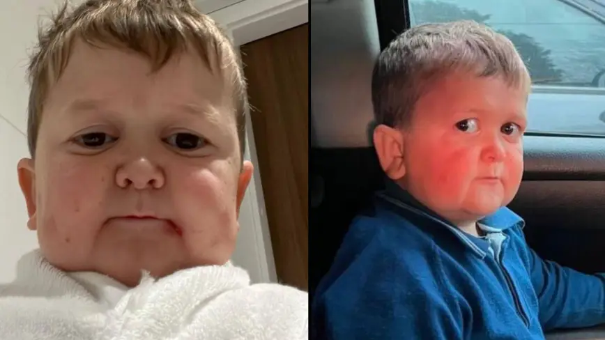 @hasbulla_/Instagram