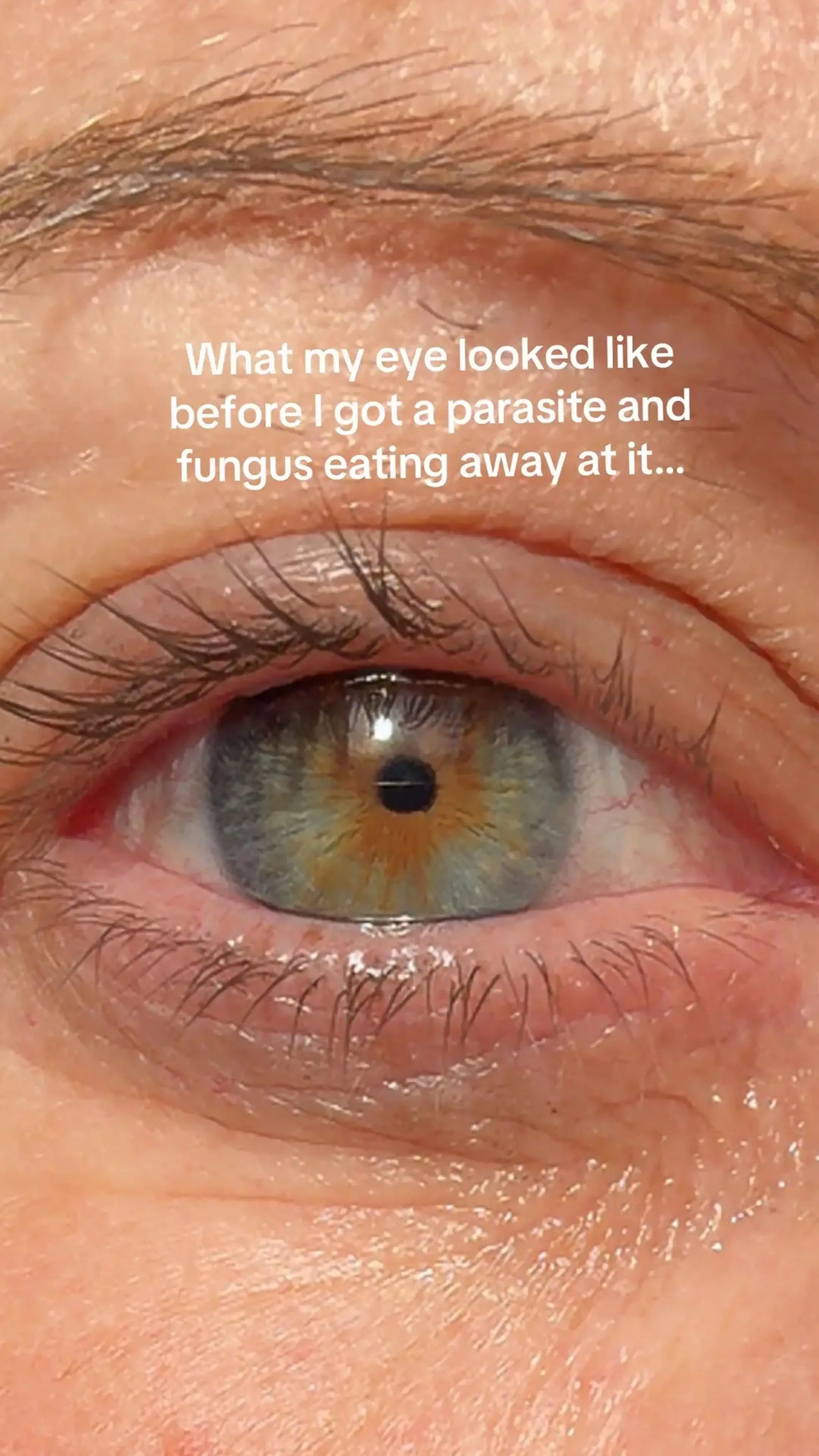 She's warning other Brits with contact lenses to be aware that getting water on them can have catastrophic consequences (Kennedy News and Media)