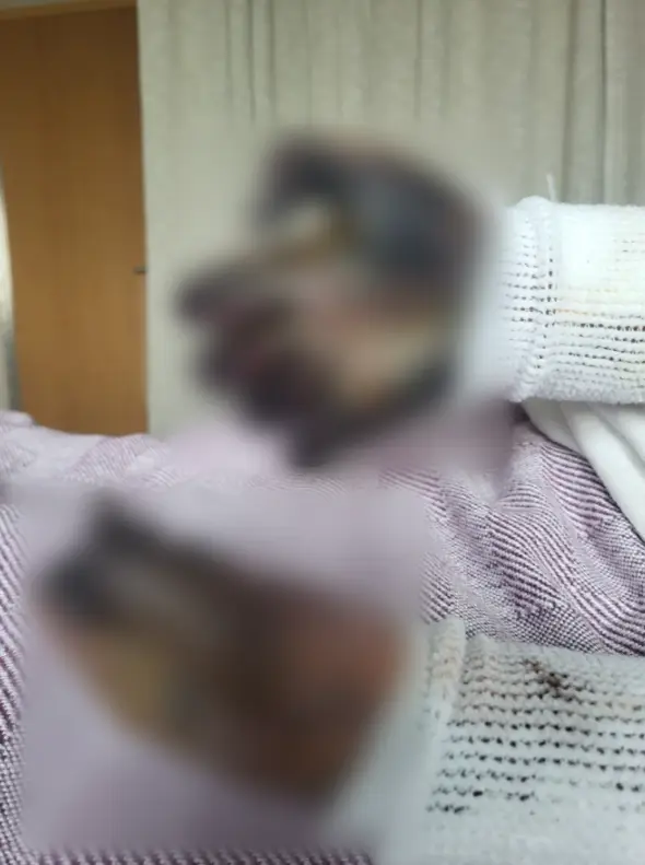 Jane suffered septic shock (Kennedy News and Media)