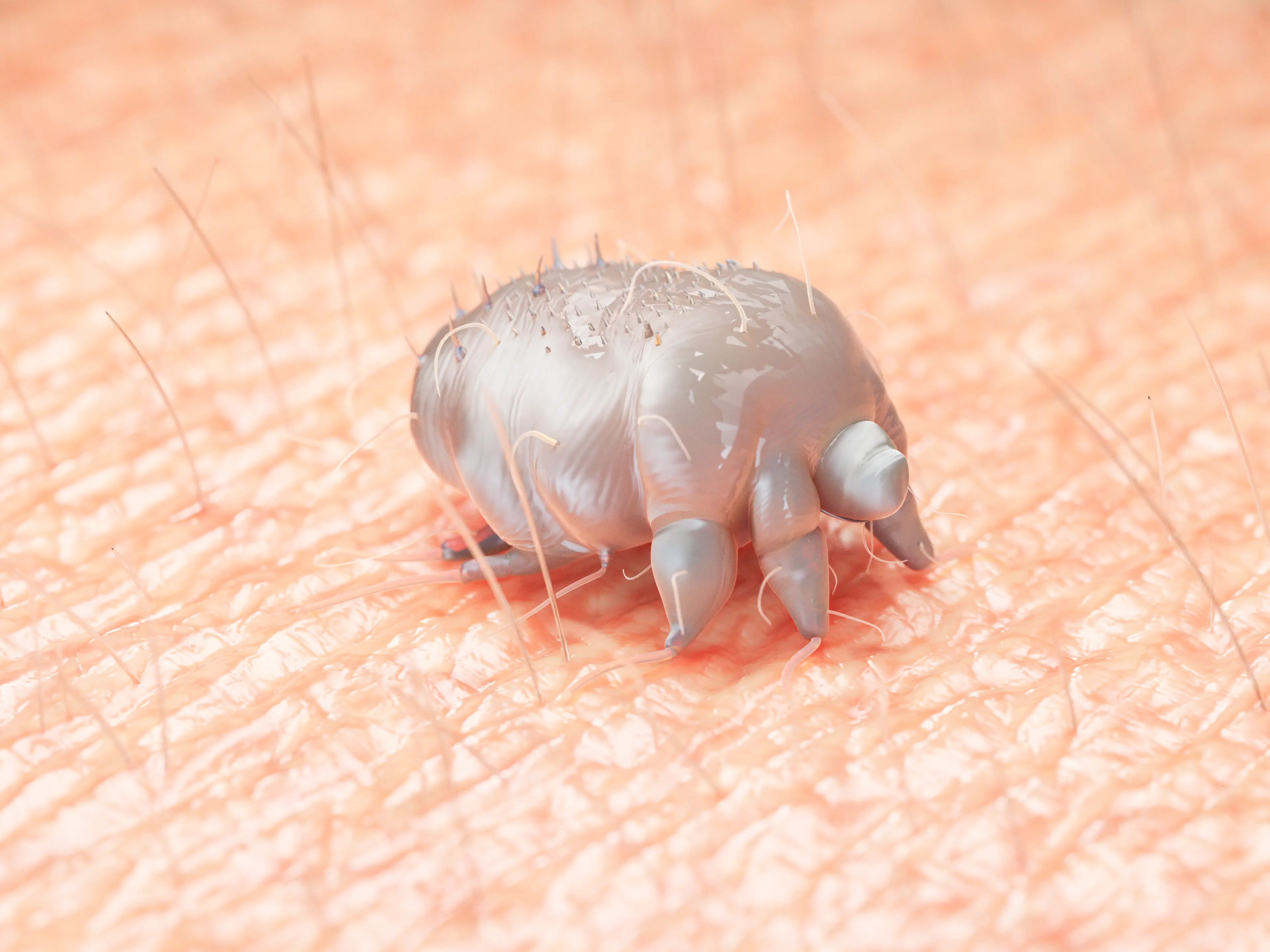 Scabies, which results in a very itchy rash, is caused by mites burrowing under your skin (Getty Stock Image)