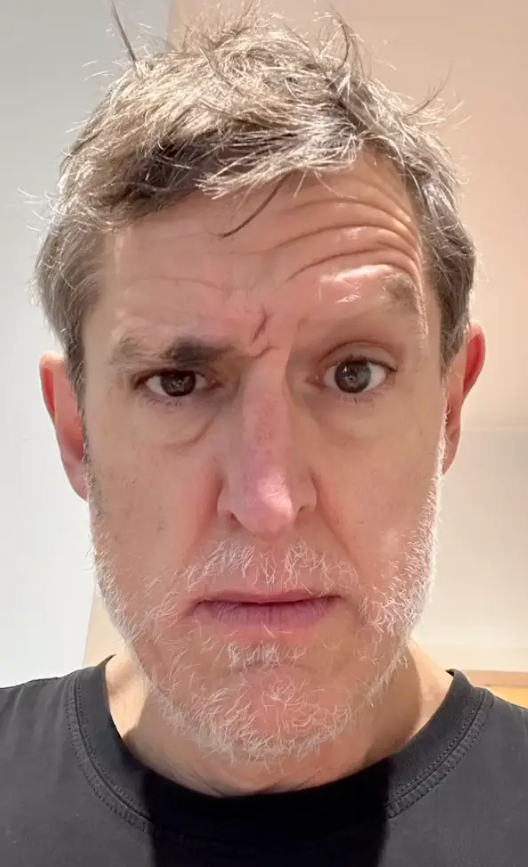 He’s asked fans for advice.