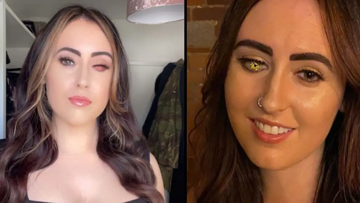 Woman Gets 'Golden Eye' After Cruel Comments About Missing Eye While Working As Barmaid