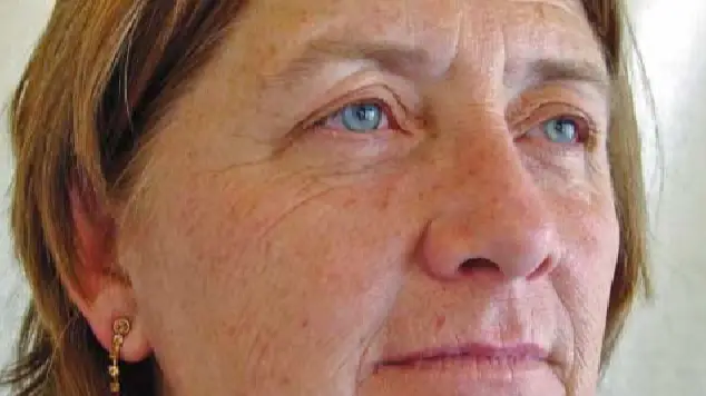 Shocking images show difference between identical twins when one smoked and the other didn't