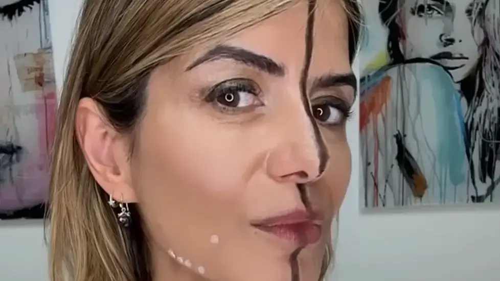 Doctor only injects one half of her face with Botox to show its true impact