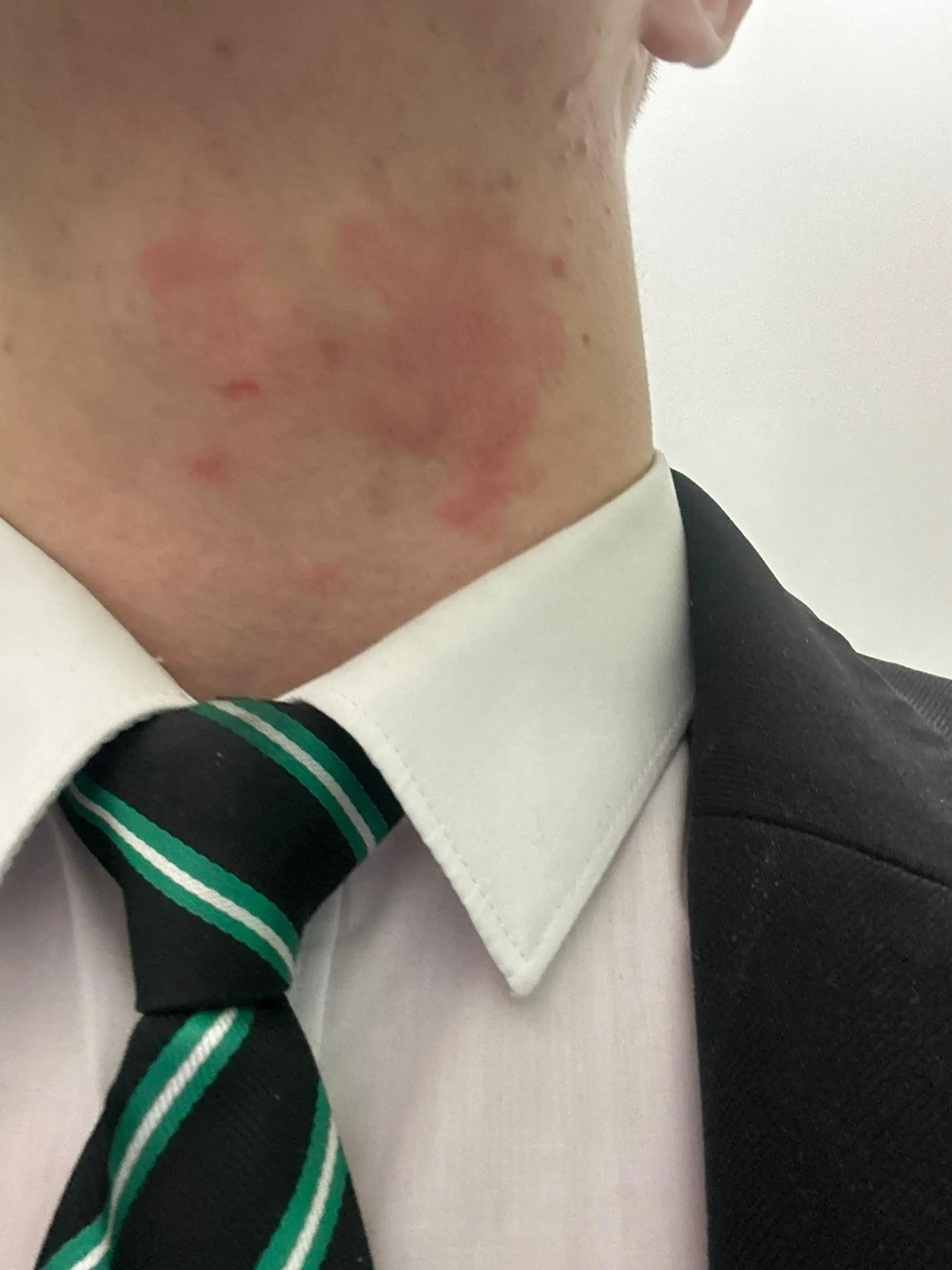 His family said the haircut helped keep his head cool and avoided his eczema from flaring up, while the school said they wouldn't be changing their policy. (SWNS)