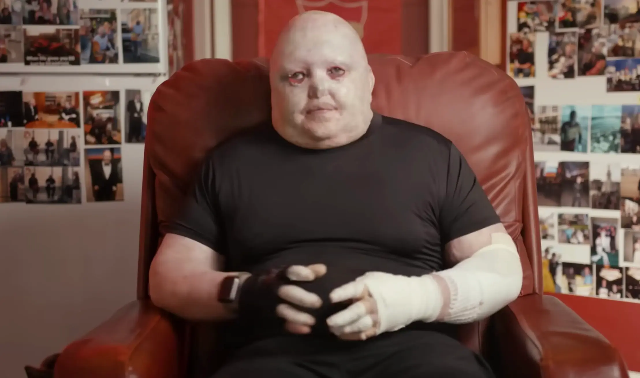 Dean Clifford has been in constant pain for his entire life (YouTube/ABCScience)