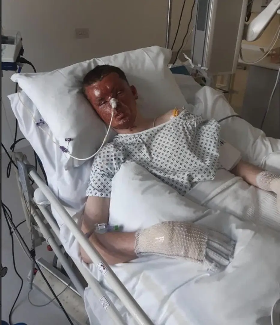 And during recovery (SWNS)