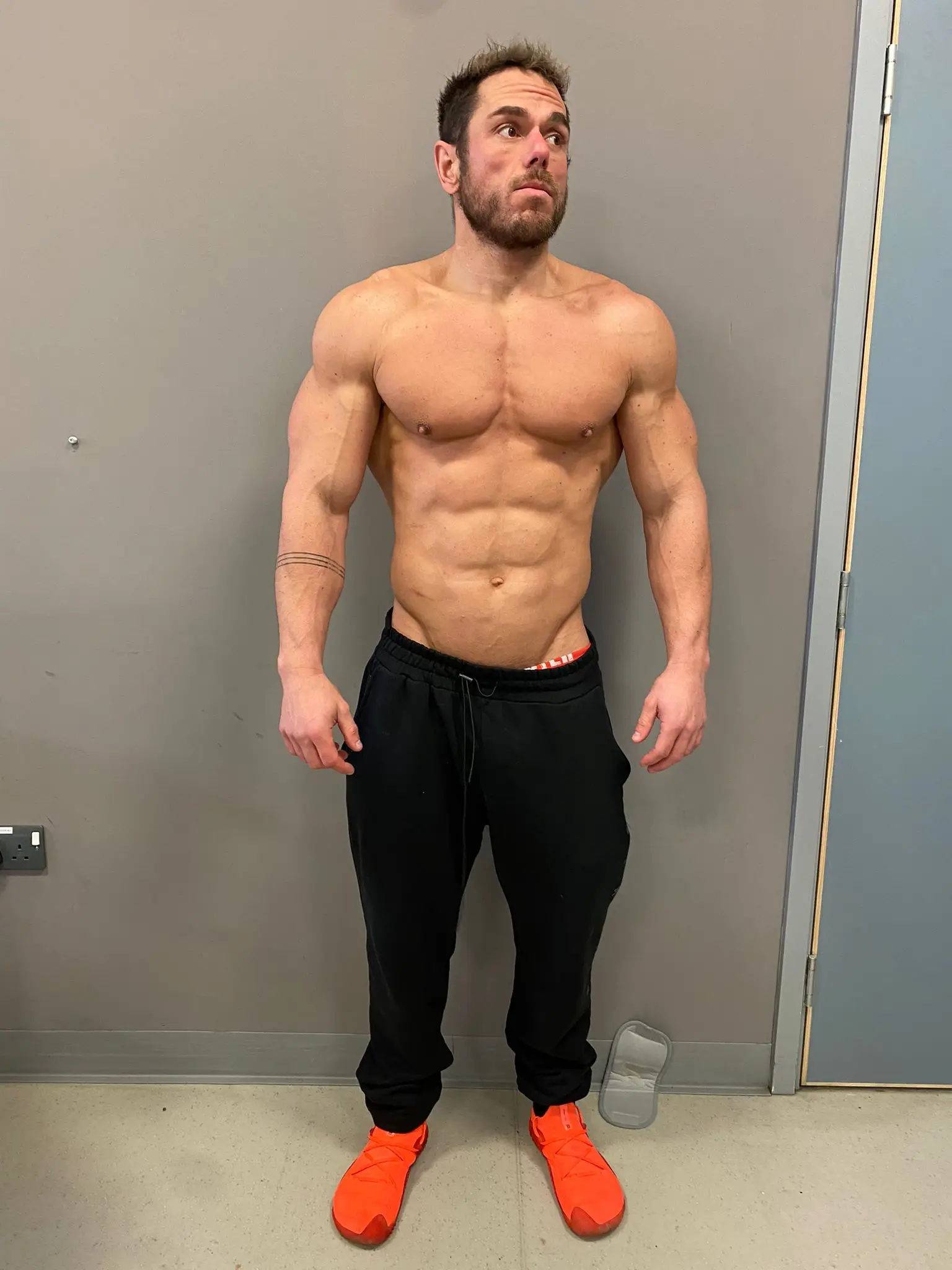 Ross after consuming over 40,000 calories in one day. (Supplied)