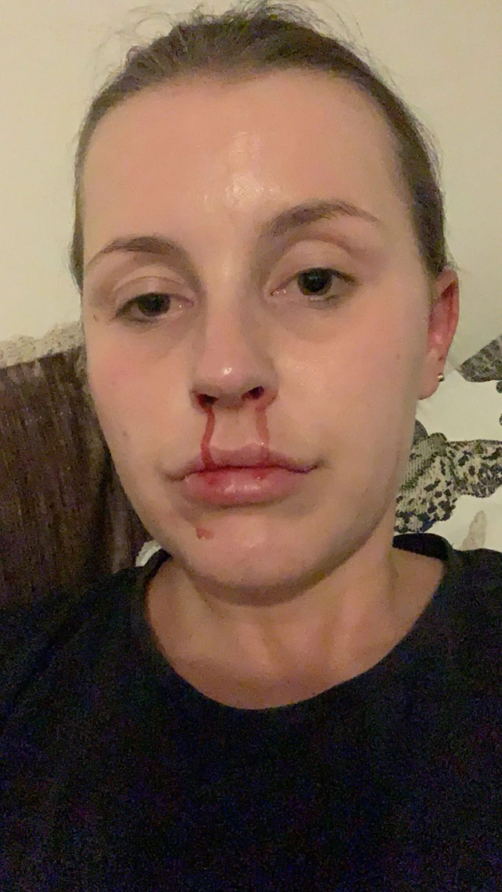 Charlee would suffer with nosebleeds due to her cocaine addiction (Kennedy News and Media)