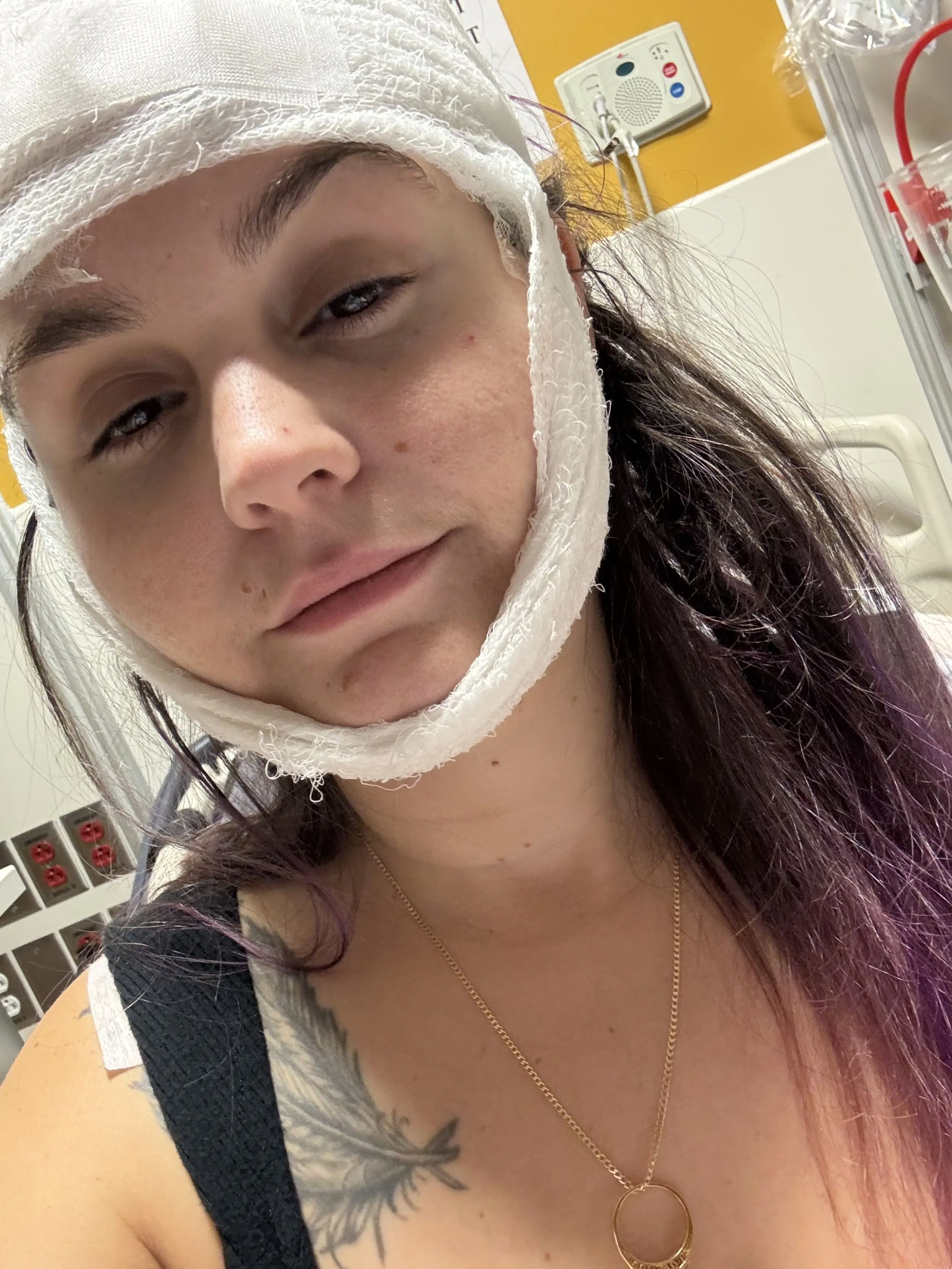 She suffered her first seizure and smashed her face on the bathroom floor, but continued using. (KNM)