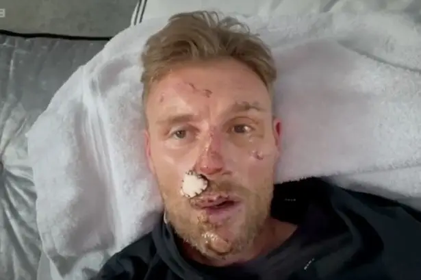Flintoff shared more graphic snaps of his accident earlier this year (BBC)