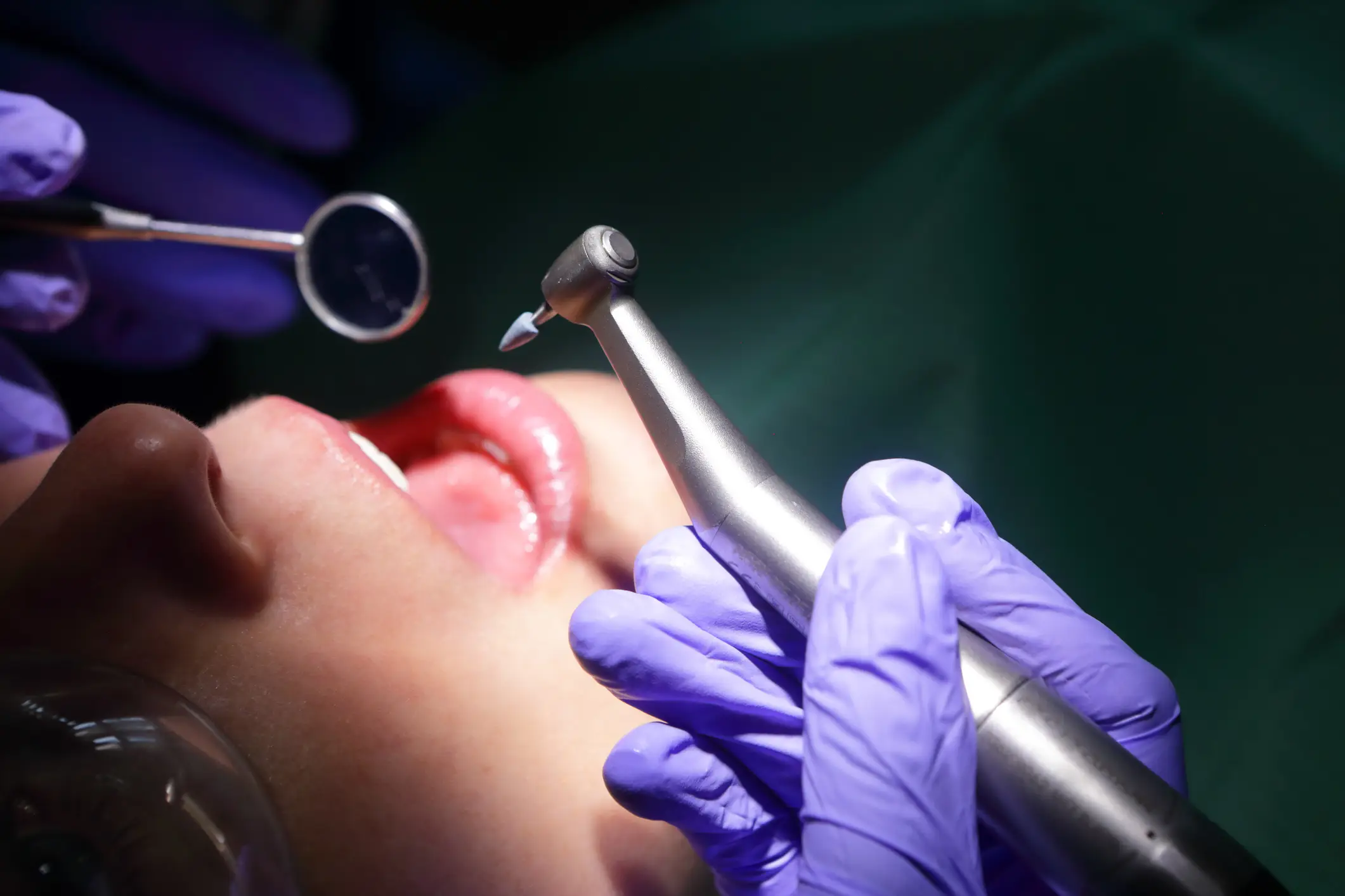 The teenager thought she was getting a standard root canal. (Getty Stock Photo)