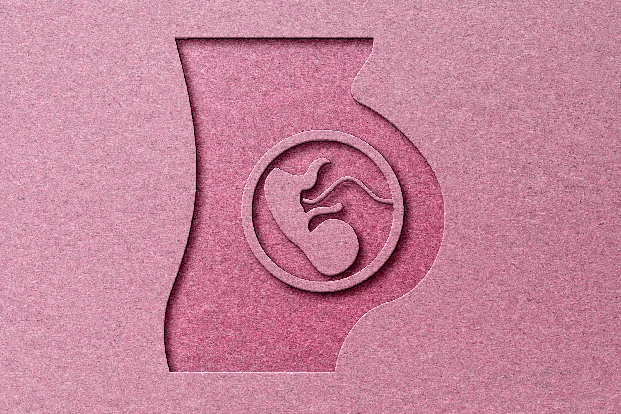 It occurs in-utero (Getty Stock Images)