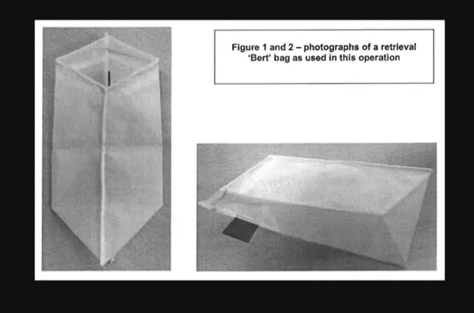 The bag was left inside of him. (BBC)