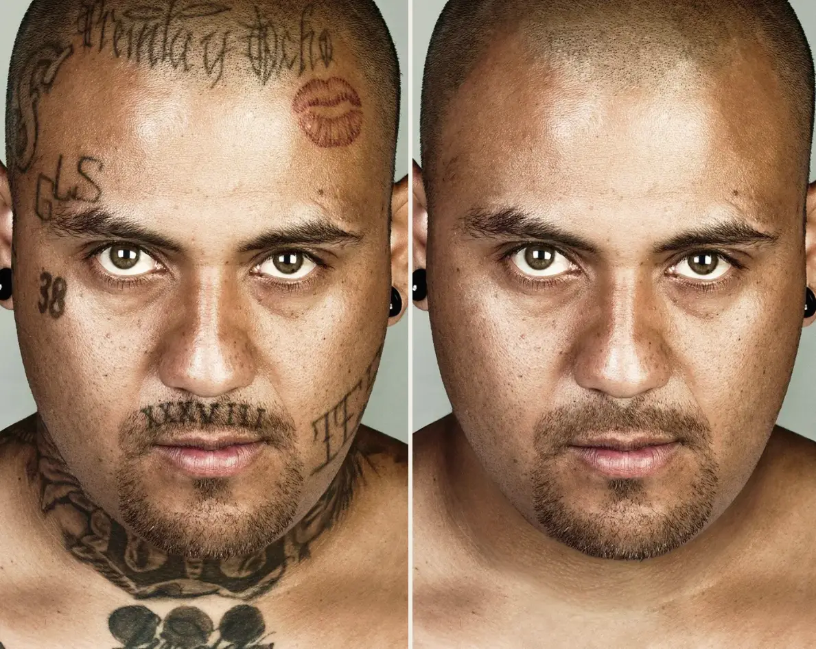 Francisco Flores said he couldn't remember 'the last time I saw myself this way' (Skin Deep Steven Burton)