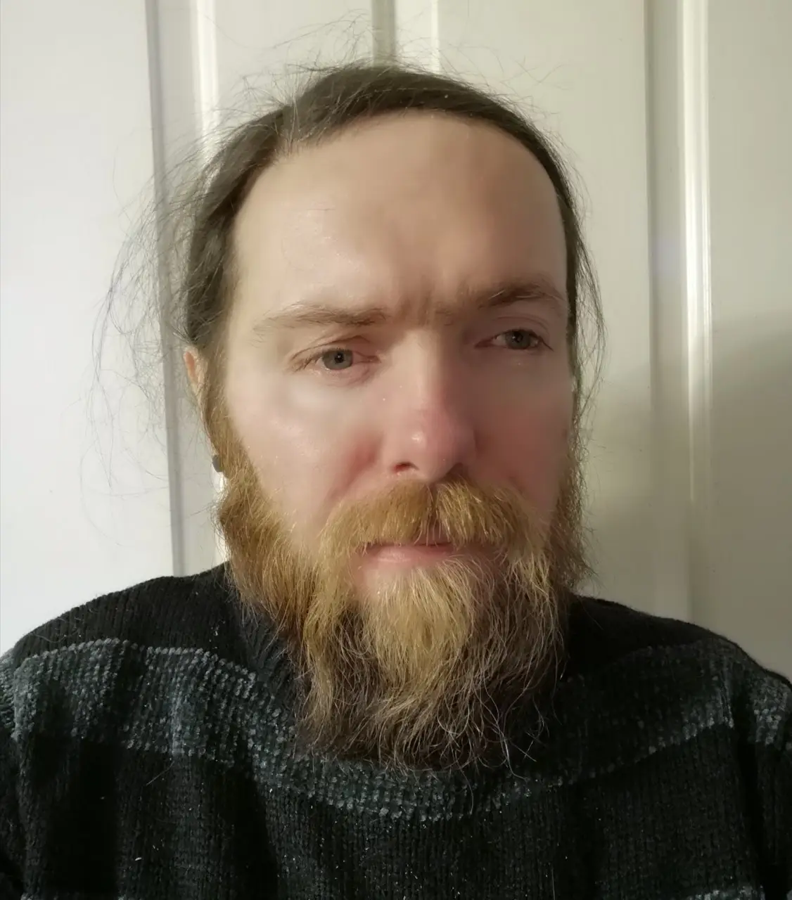 Jay Short has been turned down for numerous jobs which he believes is due to his facial disfigurement.