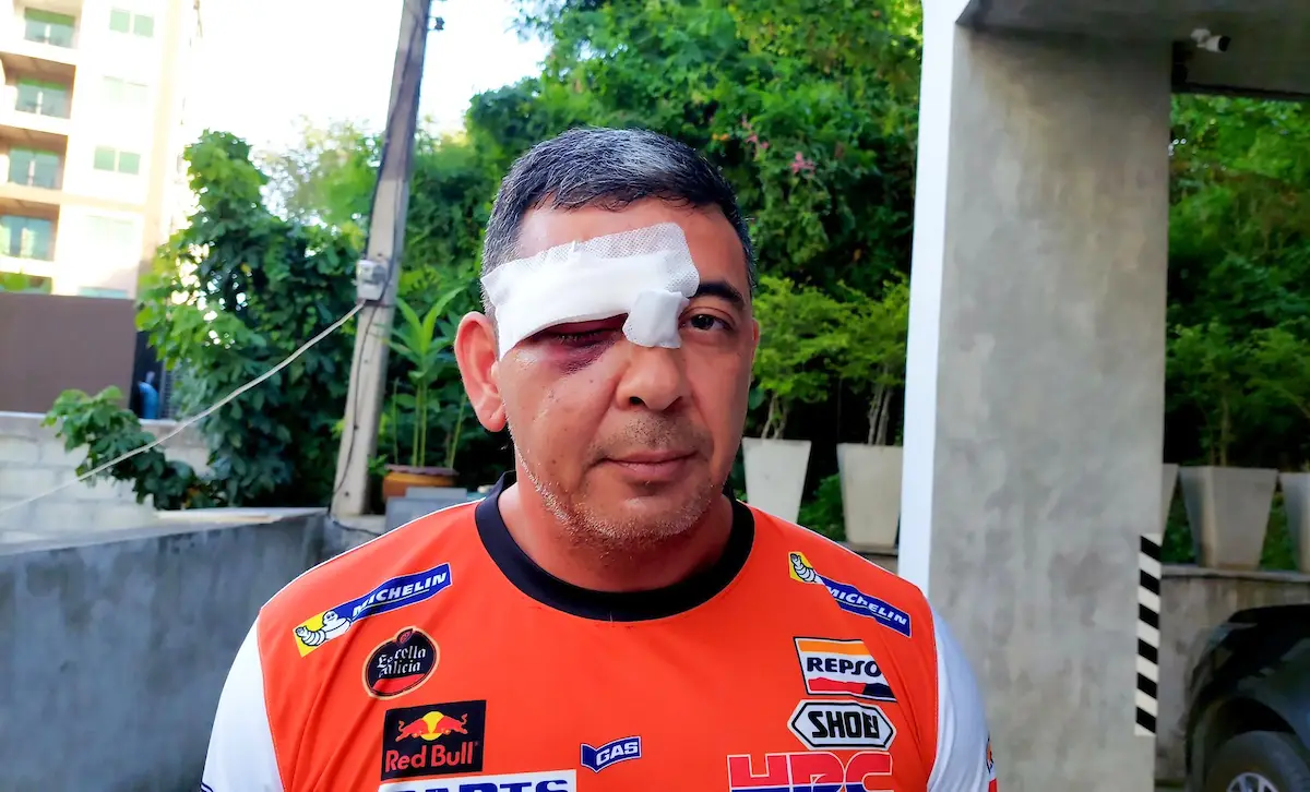 The attack left Reed seriously hurt.