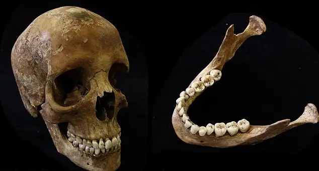 Shocking images show what smoking does to your bones (University of Leicester)