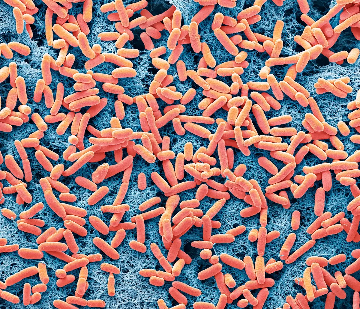 E-coli can be transmitted through contact with an infected person or animal. (Getty Stock Photo)