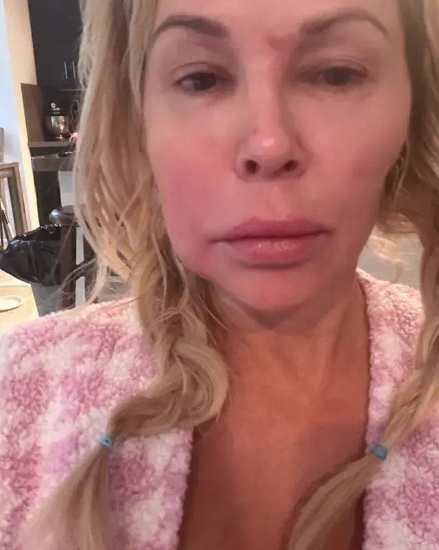 Brandi warned women to make sure they change their silicon breast implants after 10 years (Instagram/@brandiglanville)