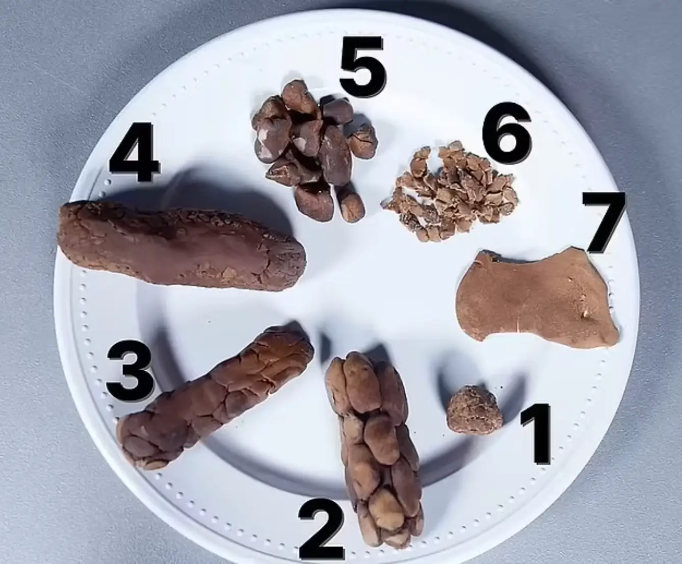 The doctor described what various shapes of poo meant.