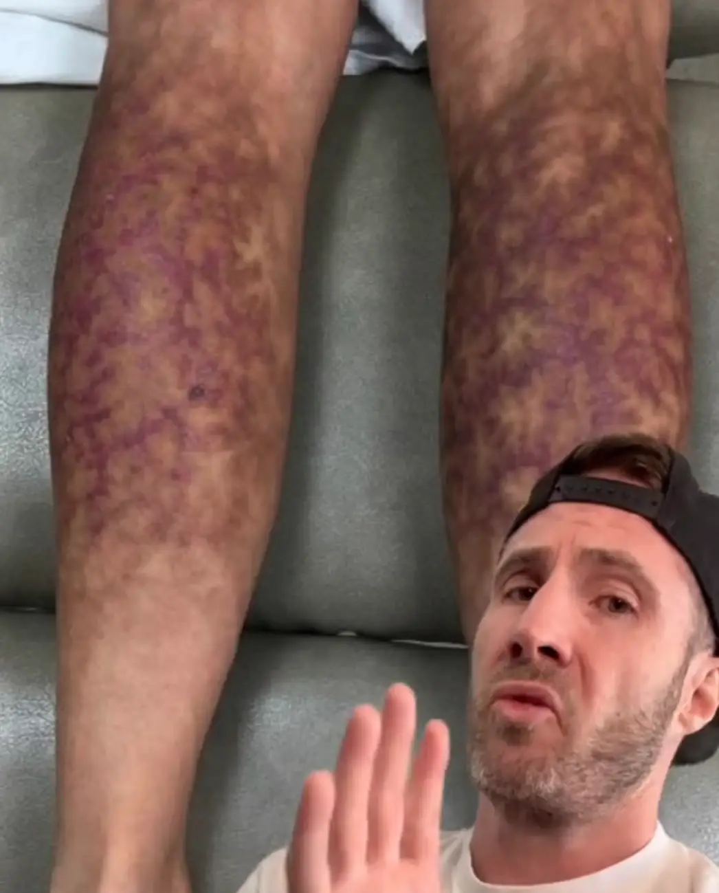 Dr Joe explained exactly what 'toasted skin syndrome' is (TikTok/@drjoe_md)