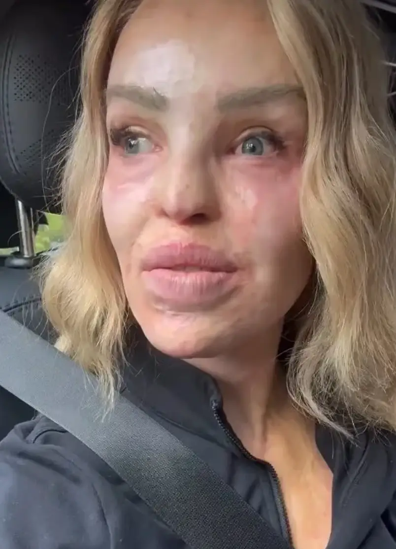 Katie Piper became emotional as she hit back at trolls (Instagram/@katiepiper_)