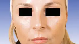 American Society for Dermatologic Surgery