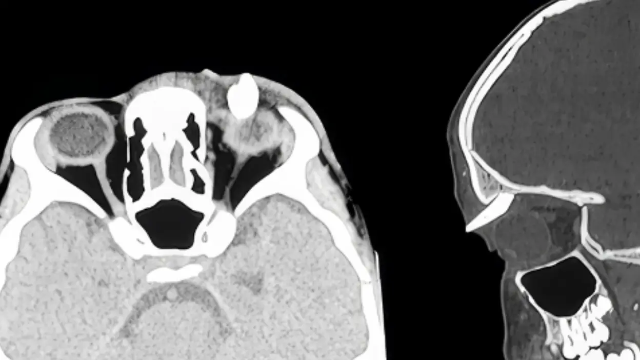 AAO Journal