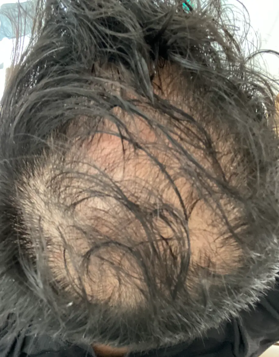 One customer shared their 'before' photograph online (Hims)