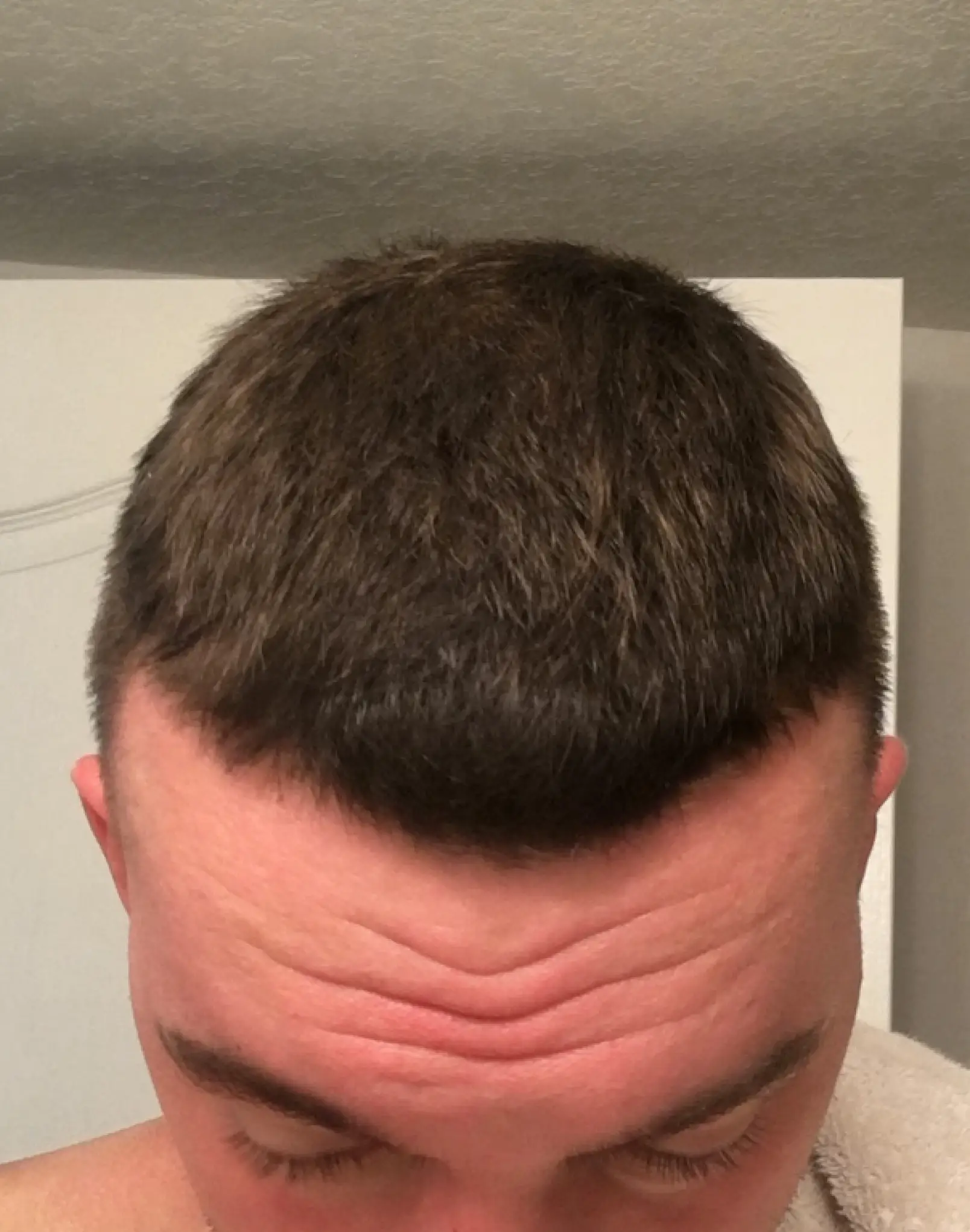 The results are admittedly impressive (Hims)