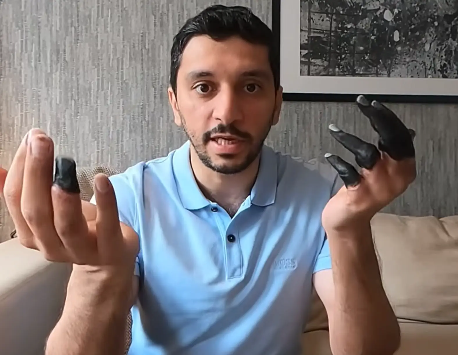 The mountain climber showed what frostbite had done to his fingers. (YouTube/Fahad Badar)