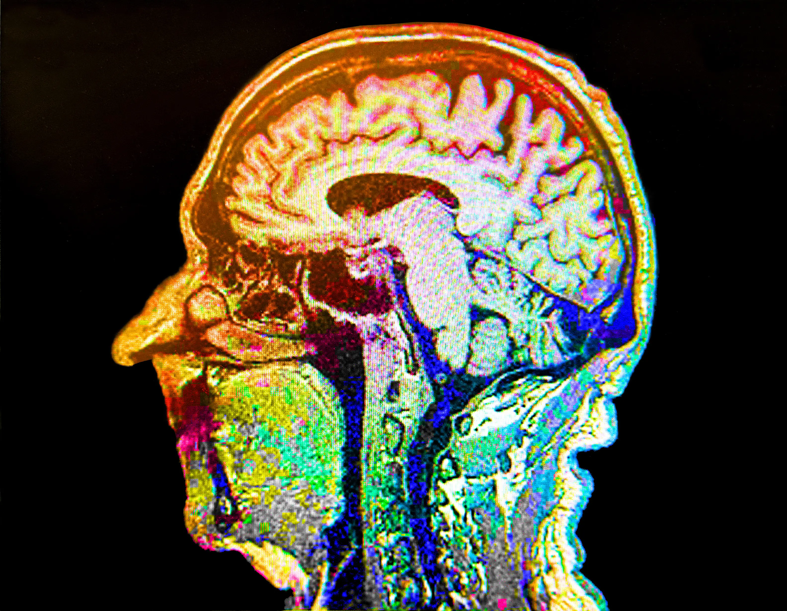 It's hoped the scorecard can help improve brain health. (Getty Stock)