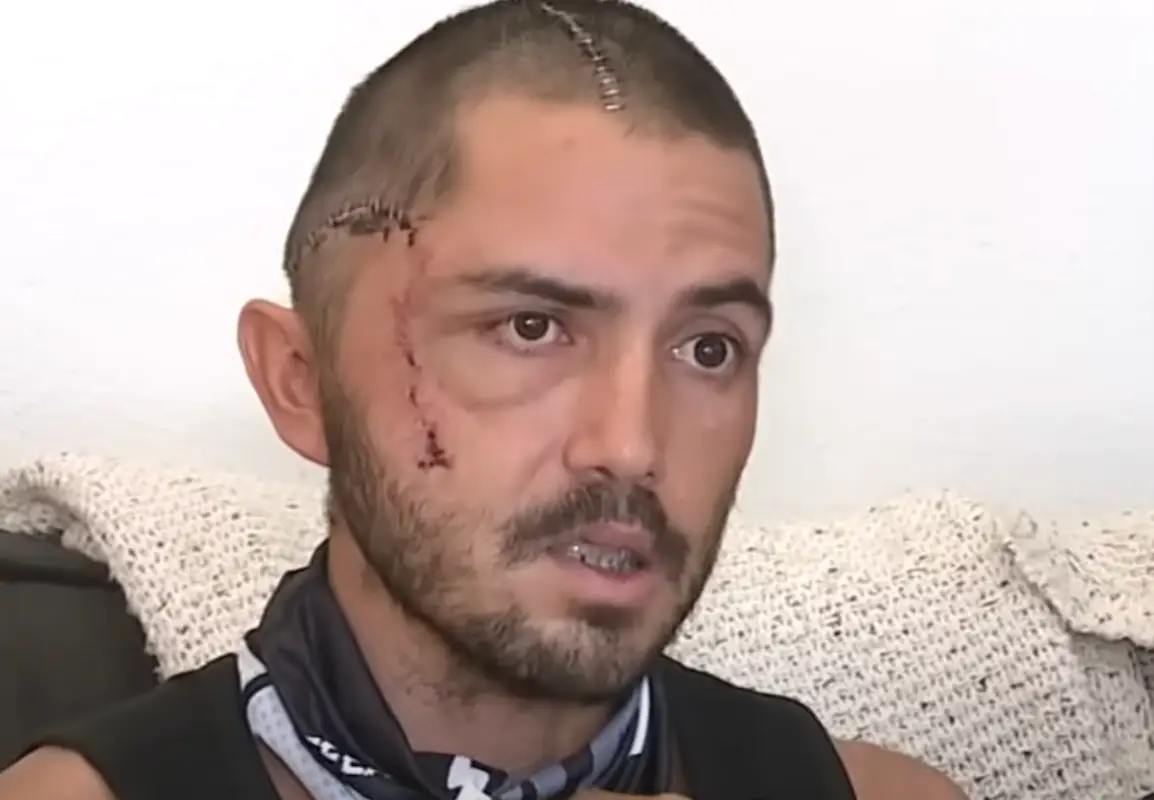 La Verde said he 'shouldn't be alive' after his attack. Youtube/ABC7