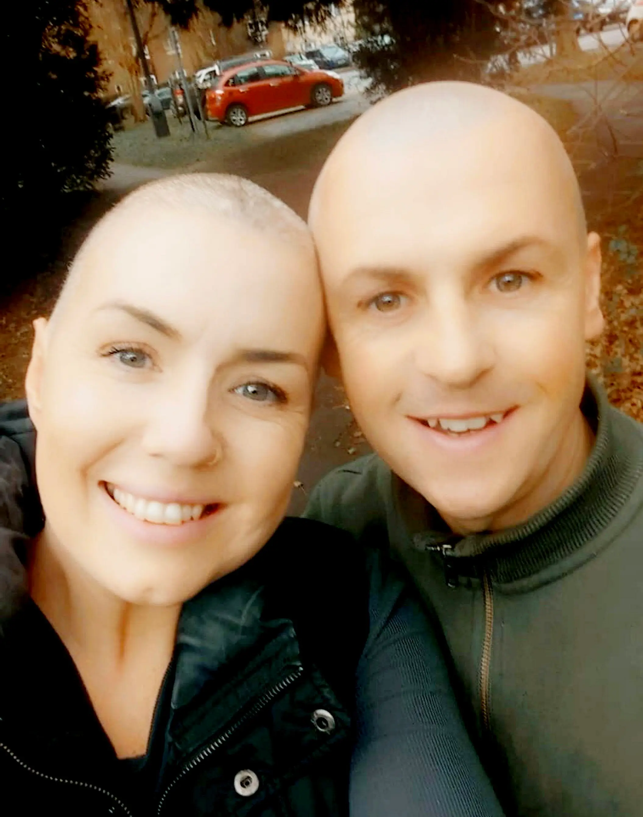 Her husband shaved his head in solidarity with Rachael (SWNS)