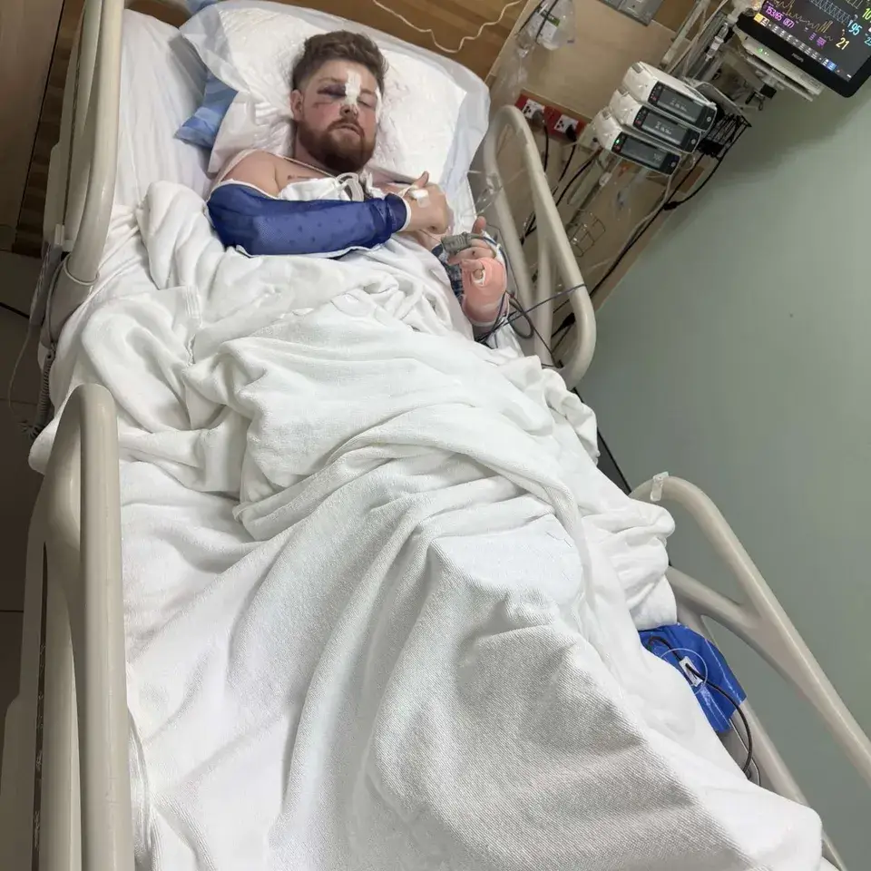 Liam survived his life threatening injuries, but now he needs help to make it home (GoFundMe)