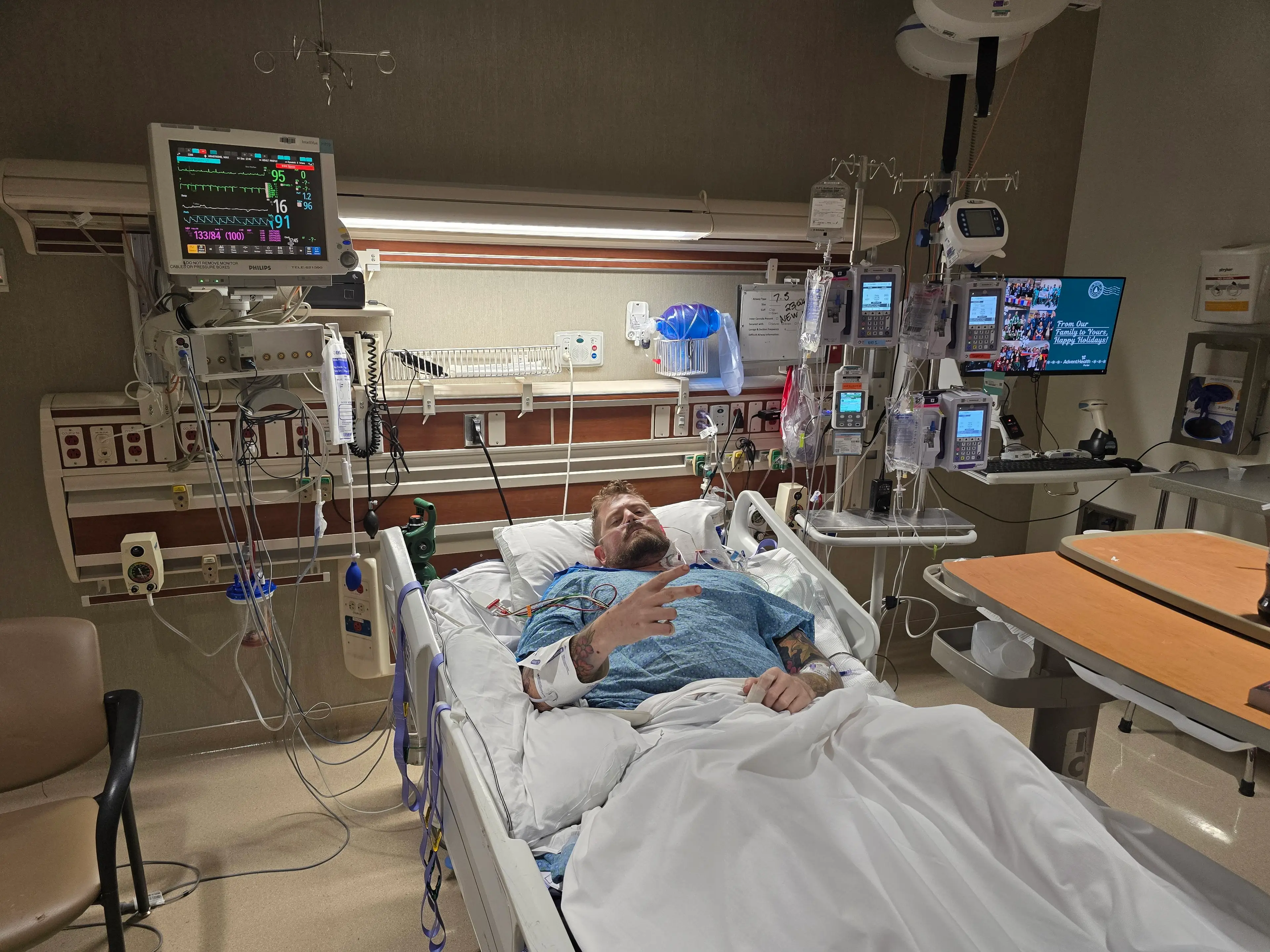 The business owner was able to survive the infection, but was forced to have his legs amputated (SWNS)