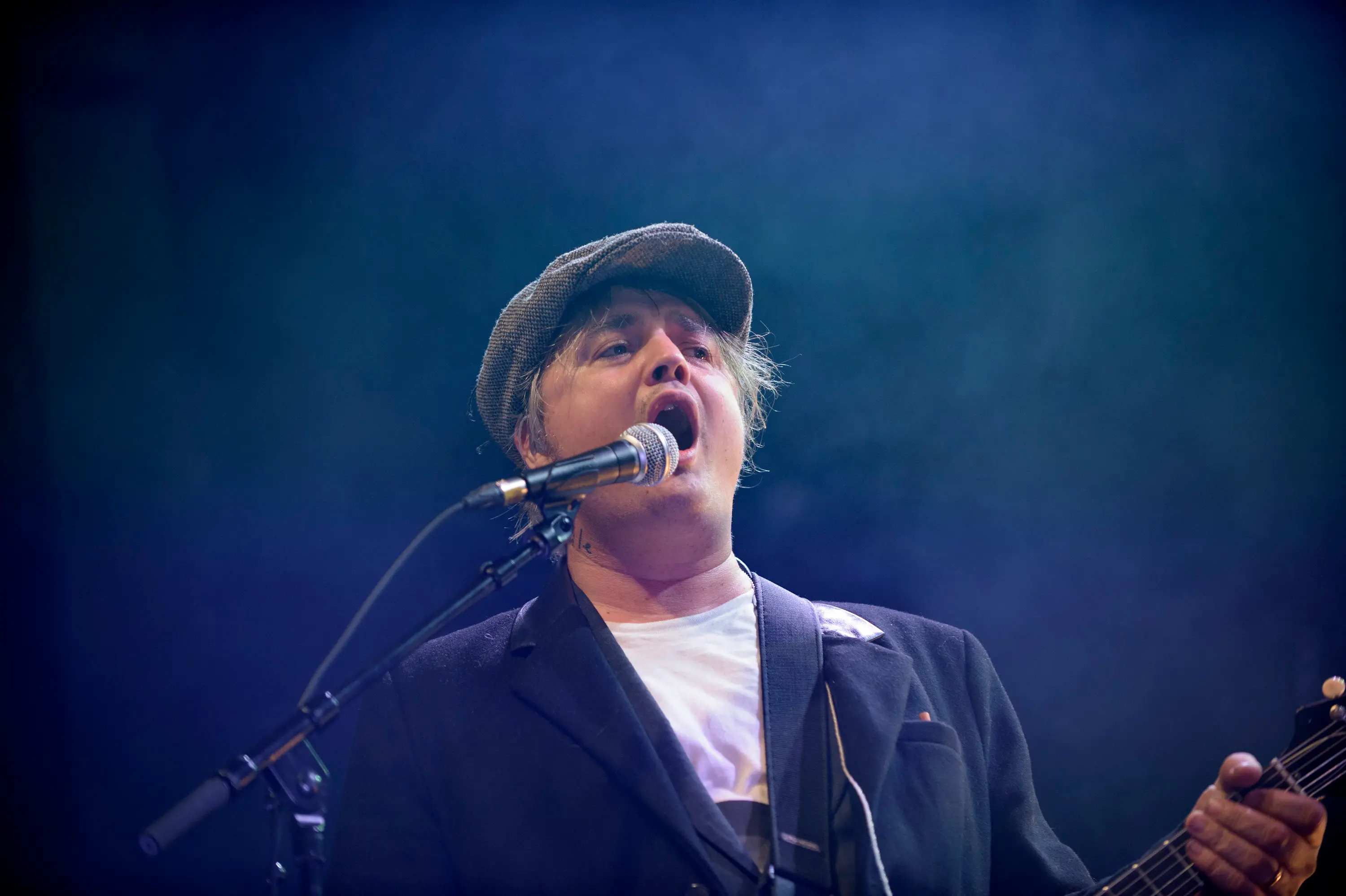Pete Doherty told fans he needs to look after his toes (Mark Holloway/Redferns)