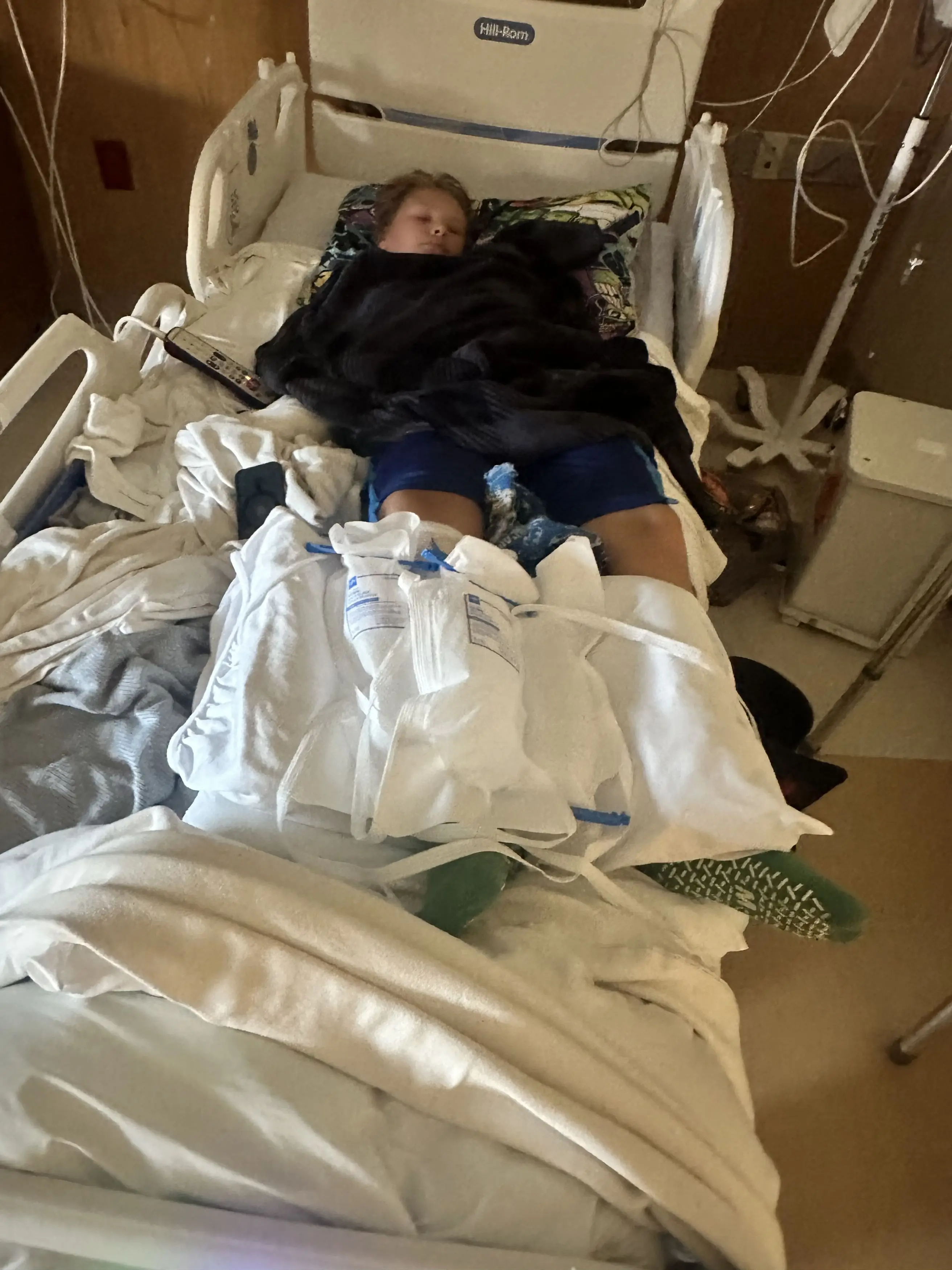 The 11-year-old may never regain full use of his leg again (Kennedy News and Media)