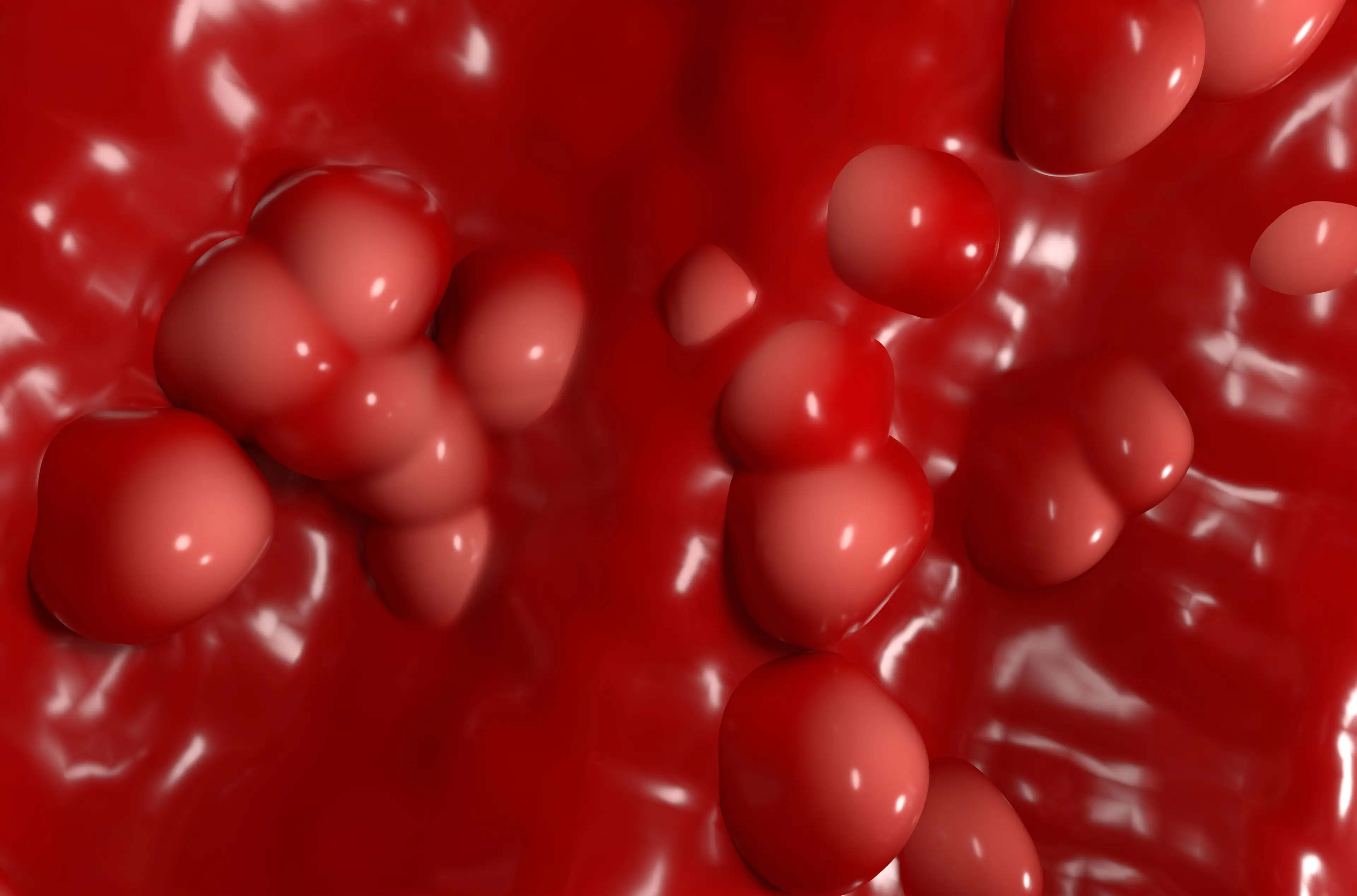 Illustration of ulcerative colitis, a form of IBD. (Getty Stock)