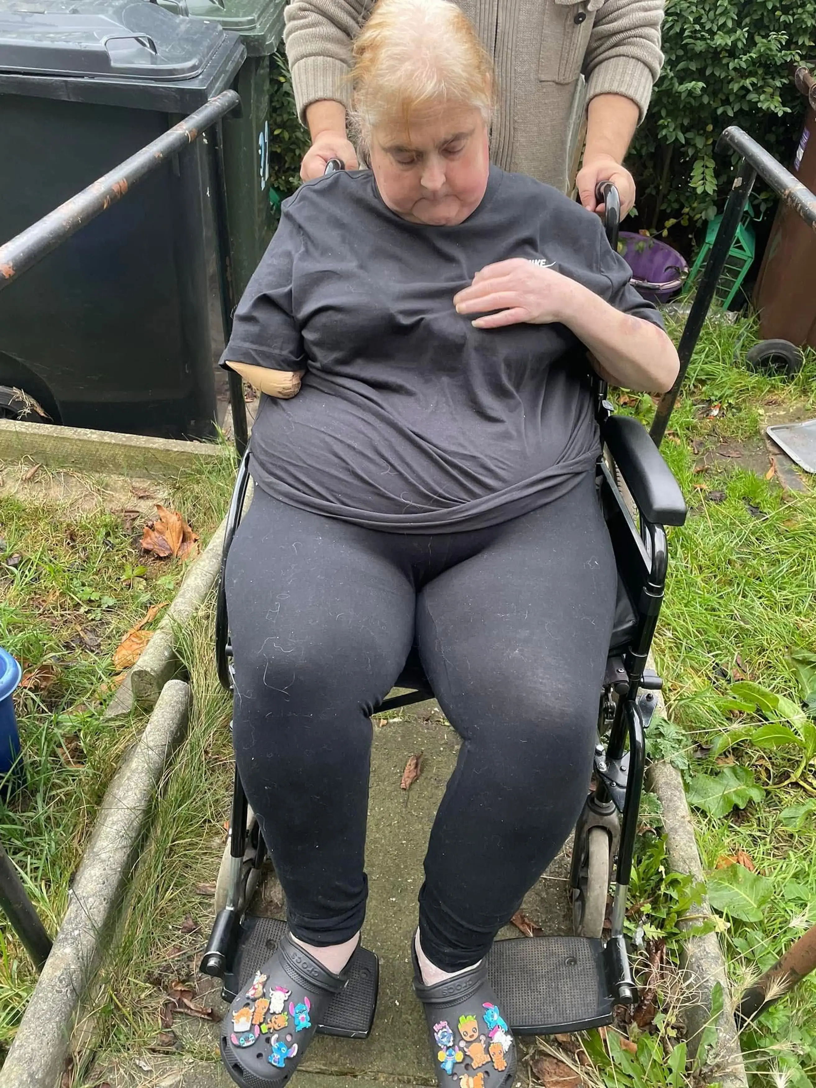 Lorraine's family believe that the amputation played a part in her death (Kennedy News and Media)