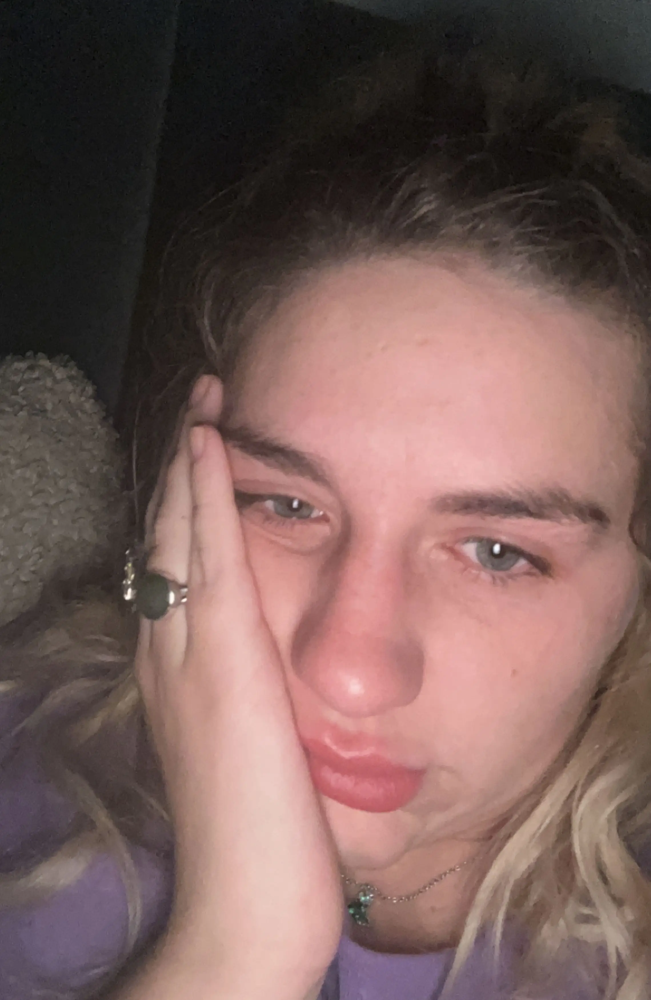 The mum, 27, said she now 'wets the bed every night' and has been 'fully incontinent' for the last five years (Kennedy News and Media)