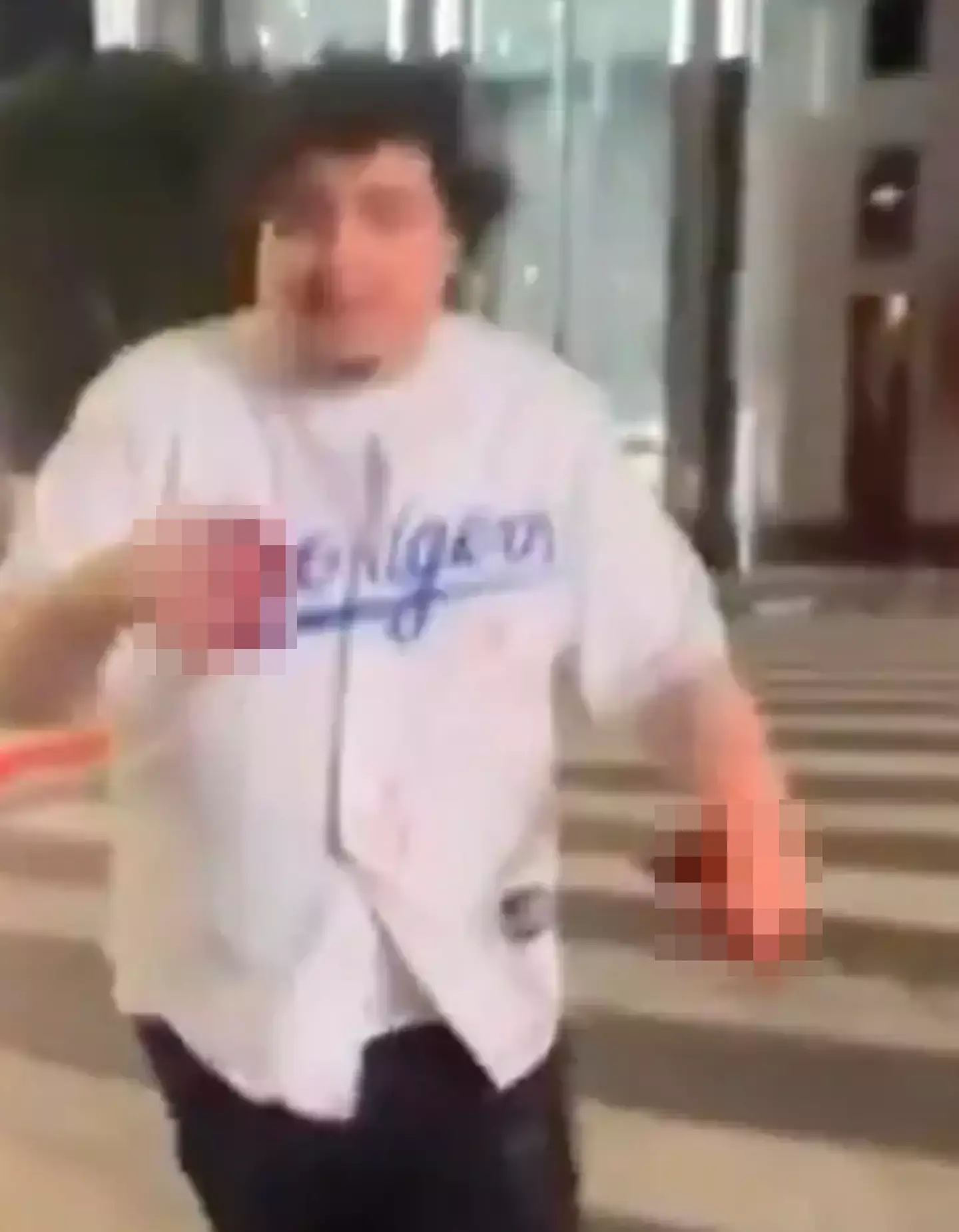 The fan suffered a serious hand injury (X/Lakeshow_323)