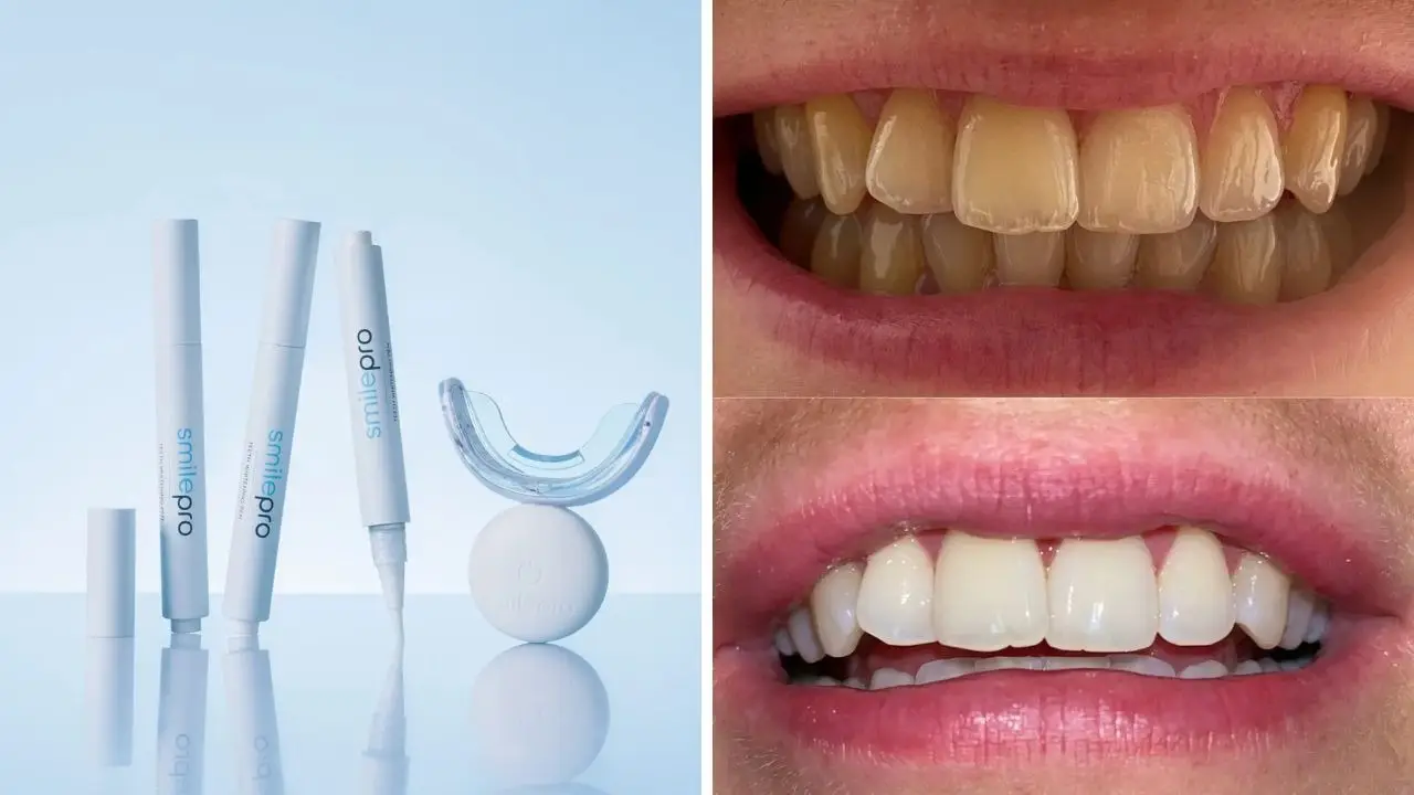 The SmilePro teeth whitening kit with thousands of five-star reviews is now 50% off