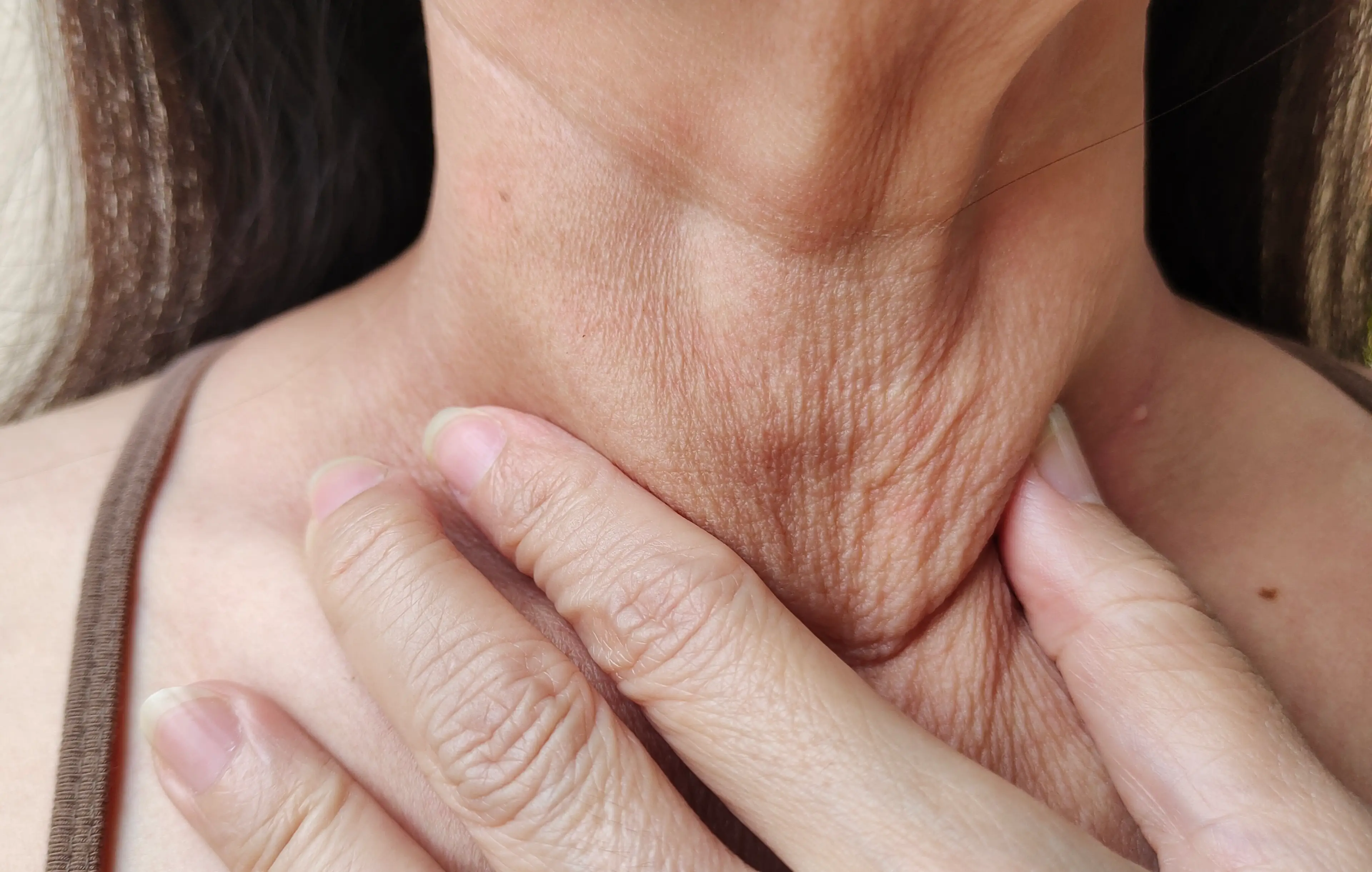 'Ozempic neck' is reportedly the latest side effect that is impacting users (Getty Stock Image)